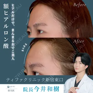 症例