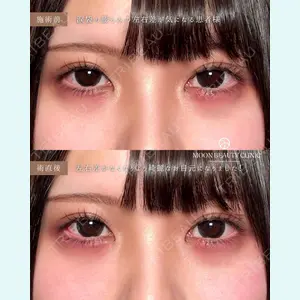 Moon Beauty Clinic 渡邉 正士医師の症例