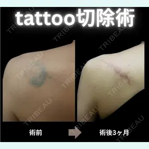 下北沢スキンクリニックの症例