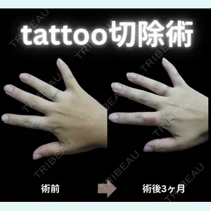 下北沢スキンクリニックの症例