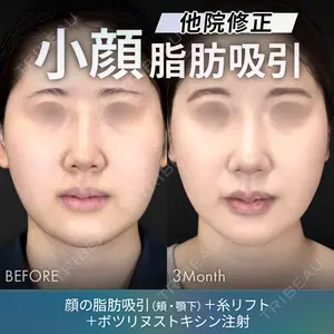 ジョウクリニック 銀座院 佐藤 光医師の症例