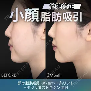 ジョウクリニック 銀座院 佐藤 光医師の症例