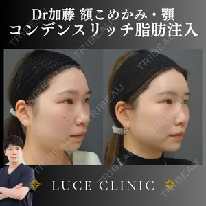 ルーチェクリニック 銀座院 加藤晴之輔医師の症例