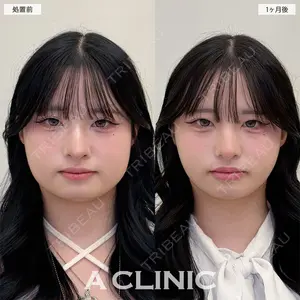 A CLINIC（エークリニック） 名古屋院 住田 篤紀医師の症例