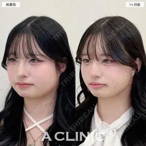 A CLINIC（エークリニック） 名古屋院 住田 篤紀医師の症例