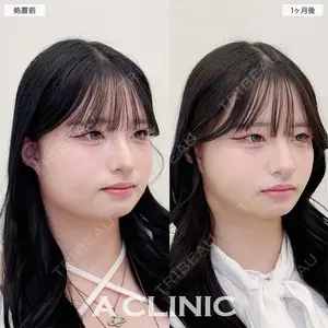 A CLINIC（エークリニック） 名古屋院 住田 篤紀医師の症例