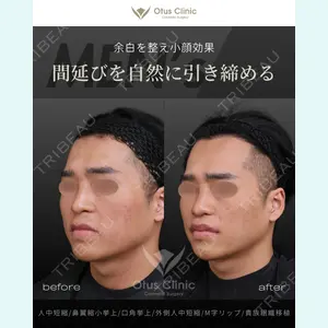 Otus Clinic 【オータスクリニック】 中 徳太郎医師の症例