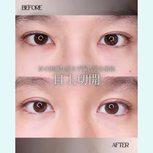 小倉美容外科/美容皮膚科 ビラビューティークリニック 大村 亞蘭医師の症例