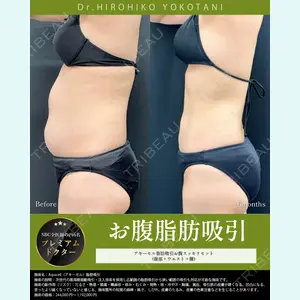 湘南美容クリニック 大阪梅田本院 横谷 仁彦医師の症例