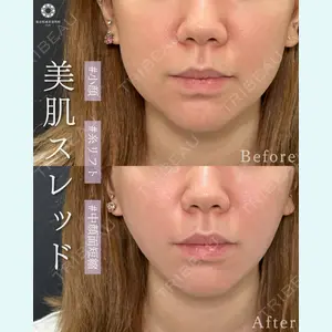 東京形成美容外科 池袋院の症例