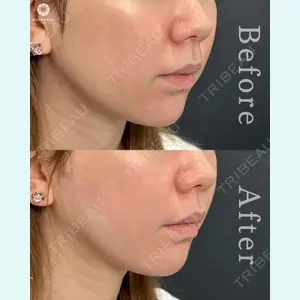 東京形成美容外科 池袋院の症例