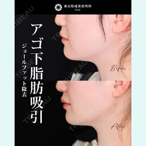 東京形成美容外科 船橋院 山崎 修吾医師の症例