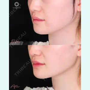 東京形成美容外科 船橋院 山崎 修吾医師の症例