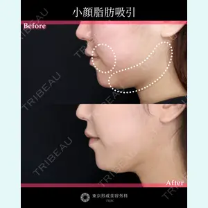 東京形成美容外科 池袋院 弓削田　浩主医師の症例