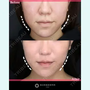 東京形成美容外科 池袋院 弓削田　浩主医師の症例