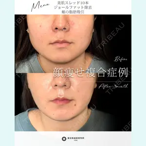 東京形成美容外科 船橋院 山崎 修吾医師の症例