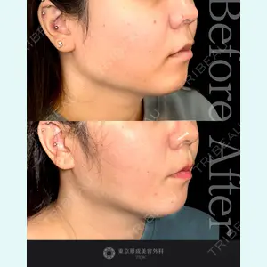 東京形成美容外科 船橋院 山崎 修吾医師の症例