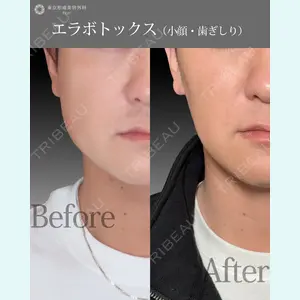 東京形成美容外科 船橋院 山崎 修吾医師の症例