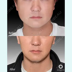 東京形成美容外科 船橋院 山崎 修吾医師の症例