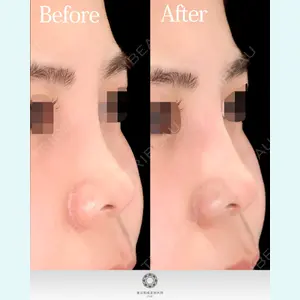 東京形成美容外科 池袋院の症例