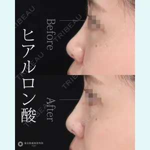 東京形成美容外科 池袋院の症例