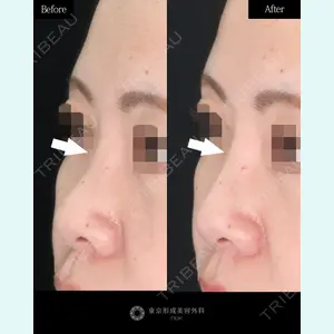 東京形成美容外科 池袋院の症例