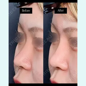 東京形成美容外科 池袋院の症例