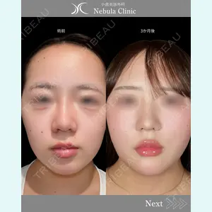 小倉美容外科ネビュラクリニック 浦野 正樹医師の症例