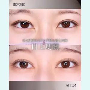 小倉美容外科/美容皮膚科 ビラビューティークリニック 大村 亞蘭医師の症例