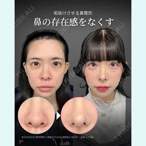 東京シンデレラ美容外科 新宿院 吉原 伯医師の症例