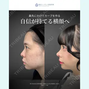 東京シンデレラ美容外科 新宿院 吉原 伯医師の症例