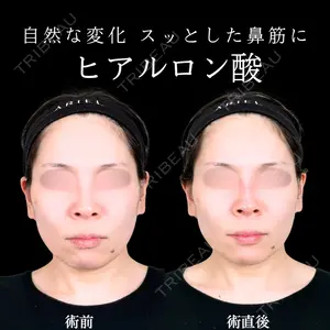 アリエル美容クリニック 水戸院 天白 典秀医師の症例