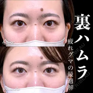 EMMO FACE CLINIC 大宮院 百瀬 直也医師の症例