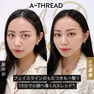 A CLINIC（エークリニック） 新宿院の症例