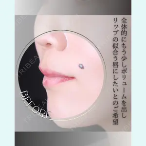 小倉美容外科/美容皮膚科 ビラビューティークリニック 大村 亞蘭医師の症例