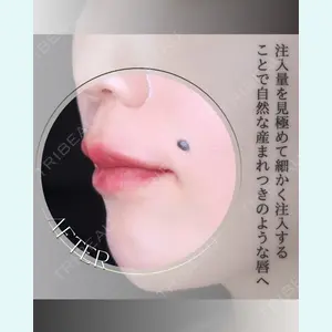 小倉美容外科/美容皮膚科 ビラビューティークリニック 大村 亞蘭医師の症例