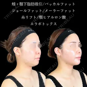 アリエル美容クリニック 大宮院 鈴木　桂介医師の症例