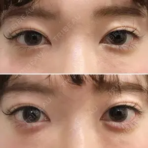 しのぶ皮膚科 蘇原しのぶ医師の症例