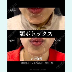 症例