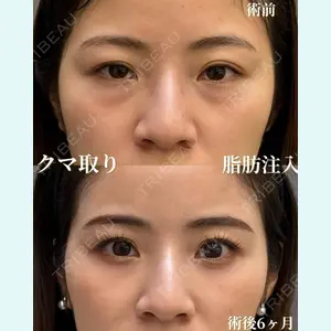 お茶の水美容形成クリニック 吉井 健吾医師の症例