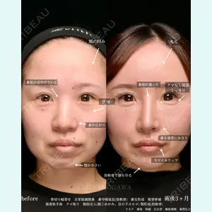Zetith Beauty Clinic 銀座院 小川 悟史医師の症例