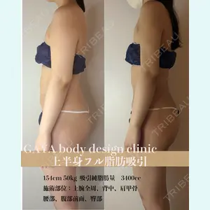 GAYA body design clinicの症例