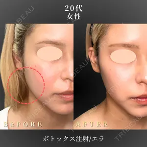 BiBiクリニック 山本 幸一郎医師の症例