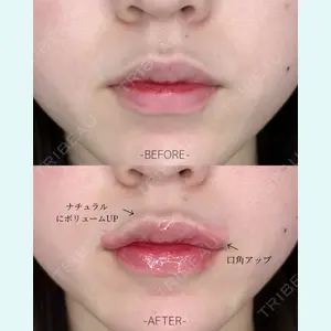 ルラ美容クリニック 大宮院 / ルラスキンクリニック 大宮院 右京 大季医師の症例