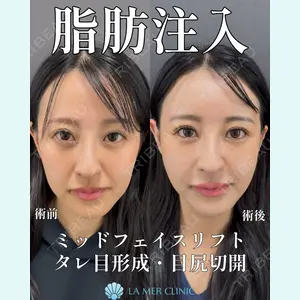 LA MER CLINIC 辻 航平医師の症例