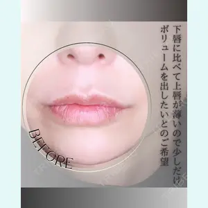 小倉美容外科/美容皮膚科 ビラビューティークリニック 大村 亞蘭医師の症例