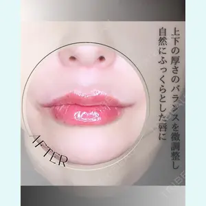 小倉美容外科/美容皮膚科 ビラビューティークリニック 大村 亞蘭医師の症例