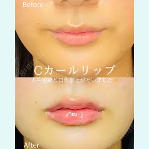 ルラ美容クリニック 仙台院 / ルラスキンクリニック 仙台院 橋本 英樹医師の症例