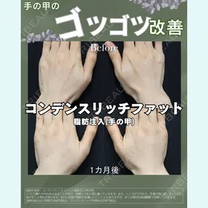 Re:Birth Clinic Nagoya 河之口 大輔医師の症例