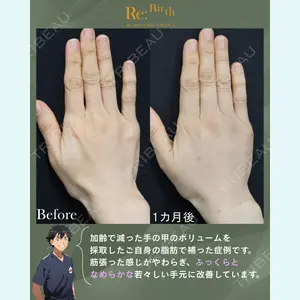 Re:Birth Clinic Nagoya 河之口 大輔医師の症例